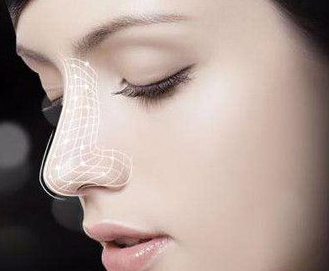 襄陽維多利亞整形醫(yī)院鼻小柱延長