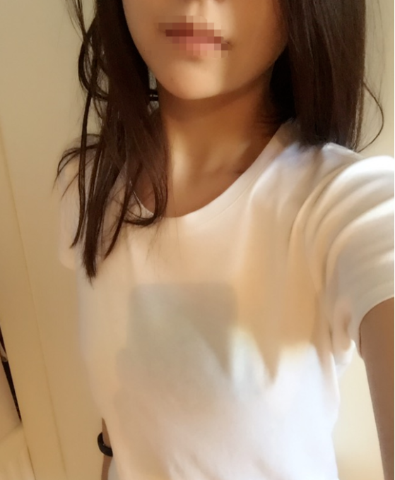 東莞韓美整形醫(yī)院醫(yī)生黃玉潔做假體隆胸怎么樣？附案例效果圖