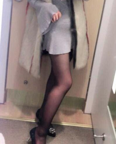 上海保加醫(yī)療美容門診部做大腿吸脂怎么樣？附楊勇醫(yī)生案例效果對(duì)比圖