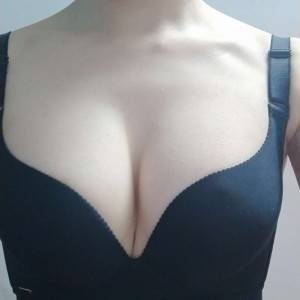 長(zhǎng)沙亞韓醫(yī)學(xué)美容醫(yī)院醫(yī)生鄭京湘做假體隆胸怎么樣？附醫(yī)生案例效果對(duì)比圖