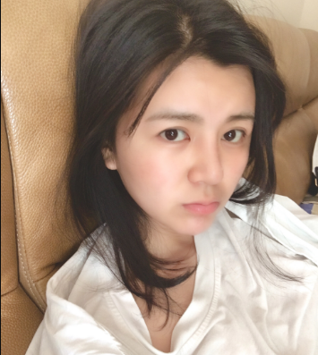 上海時光整形外科醫(yī)院醫(yī)生何晉龍做假體隆胸怎么樣？附案例效果對比圖