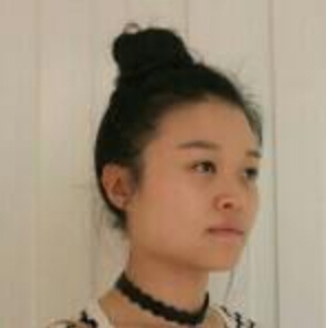 鄭州管城中醫(yī)院整形美容中心醫(yī)生張秀英做注射瘦臉怎么樣？附除皺瘦臉案例效果圖