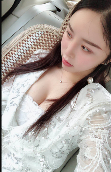 吉林現(xiàn)代整形美容醫(yī)院做假體隆胸效果怎么樣？附醫(yī)院案例效果對(duì)比圖