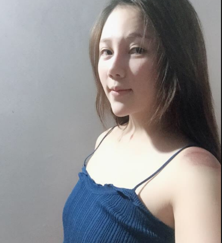 北京東方和諧醫(yī)療整形診所馮斌醫(yī)生做假體隆胸怎么樣？附案例效果對(duì)比圖