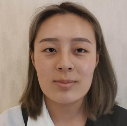 上海時(shí)光整形醫(yī)院做雙眼皮怎么樣？附石重明醫(yī)生雙眼皮+隆鼻+下頜角磨骨案例效果對(duì)比圖