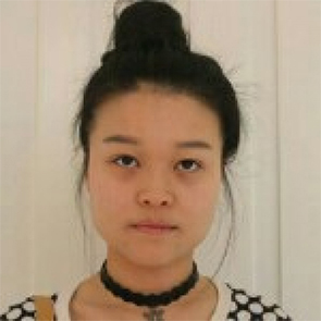 上海時(shí)光整形醫(yī)院左雯君醫(yī)生注射瘦臉針效果怎么樣？附真實(shí)案例圖