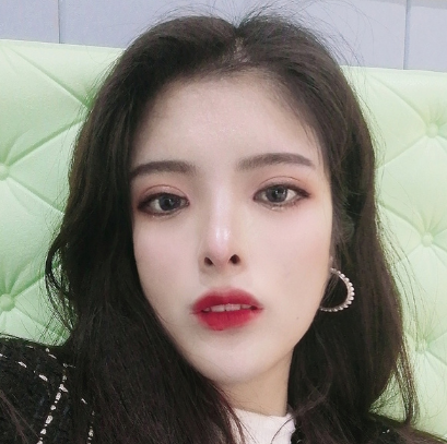 合肥韓美整形醫(yī)院做雙眼皮+開眼角效果怎么樣?附石顯武醫(yī)生真實案例效果圖 合肥韓美整形醫(yī)院做雙眼皮+開眼角效果怎么樣?附石顯武醫(yī)生真實案例效果圖