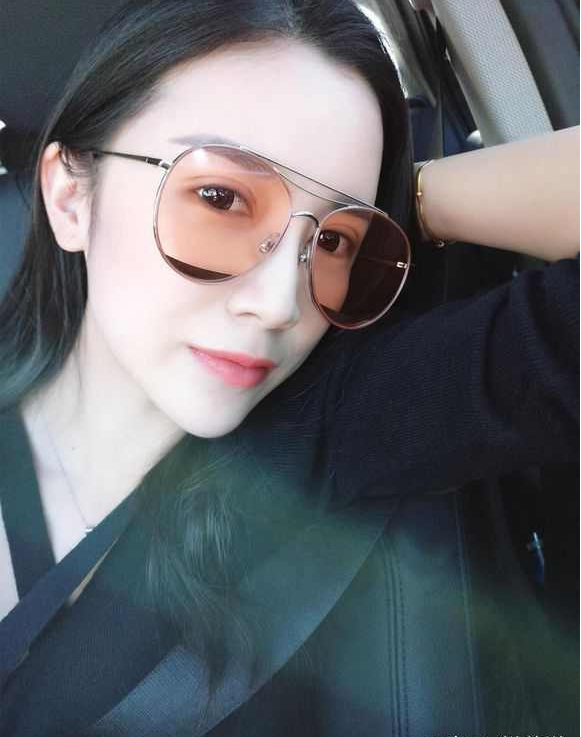 上海時光整形醫(yī)院張晶醫(yī)生做開眼角怎么樣？附真實效果圖