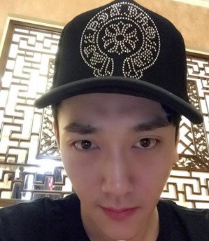 鞍山燕麗醫(yī)療美容醫(yī)院薛媚醫(yī)生做去眼袋效果怎么樣？附案例效果對比圖