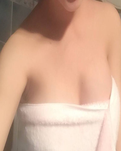 安慶市立醫(yī)院整形外科華棟醫(yī)生做自體脂肪隆胸效果怎么樣？附真實(shí)案例圖