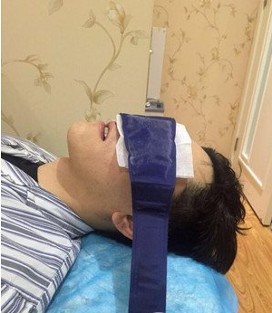 鞍山燕麗醫(yī)療美容醫(yī)院薛媚醫(yī)生做去眼袋效果怎么樣？附案例效果對比圖