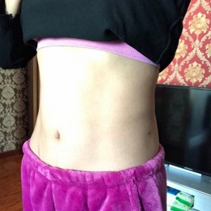 蚌埠韓美美萊整形醫(yī)生張濤做水動(dòng)力吸脂怎么樣？附吸脂案例效果圖