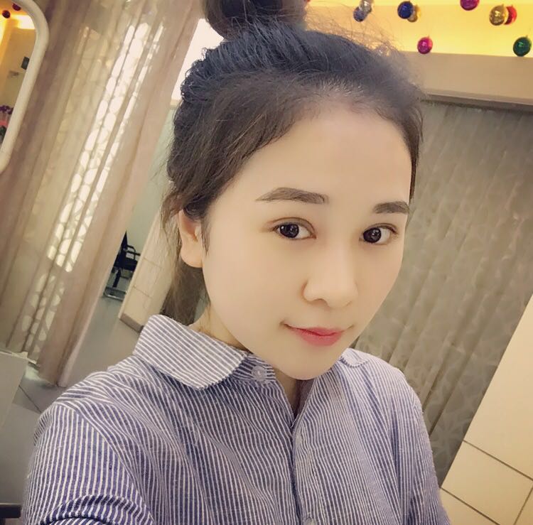 蚌埠韓美美萊整形醫(yī)生鄭捷做開眼角怎么樣？附案例效果圖