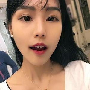 鞍山時(shí)代口腔門診部洗牙效果怎么樣？附申元休醫(yī)生洗牙案例效果圖