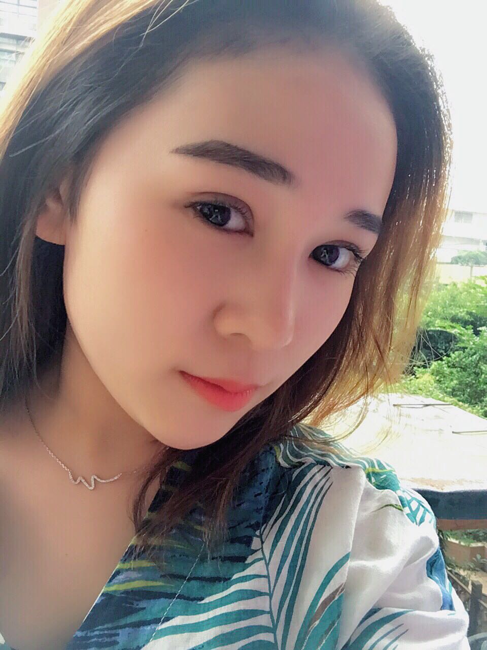 蚌埠韓美美萊整形醫(yī)生鄭捷做開眼角怎么樣？附案例效果圖