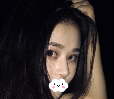 蚌埠韓美美萊整形醫(yī)生歷芳做耳軟骨隆鼻怎么樣？附耳軟骨隆鼻案例對比圖