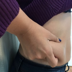 蚌埠韓美美萊整形醫(yī)生張濤做水動(dòng)力吸脂怎么樣？附吸脂案例效果圖