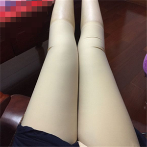 保定市第五醫(yī)院美容整形科做大腿吸脂怎么樣？附劉根立醫(yī)生案例效果圖