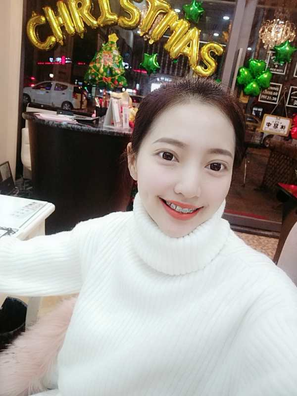 保定東陽口腔醫(yī)院溫興醫(yī)生做牙齒矯正怎么樣？附牙齒矯正案例效果對(duì)比圖