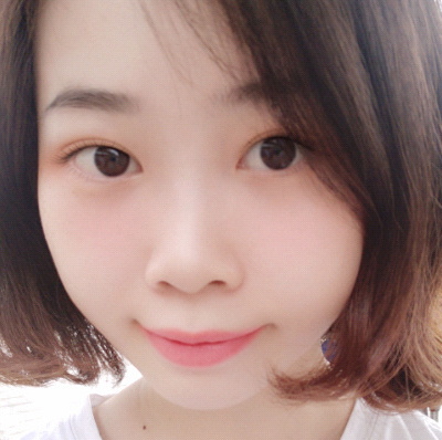 保定安卓貝拉醫(yī)療美容門診部孫大山醫(yī)生做雙眼皮+去眼袋怎么樣？附案例效果對比圖