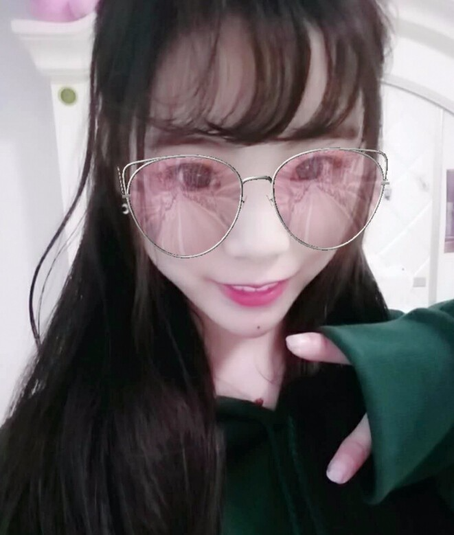 保定市第五醫(yī)院美容整形科做玻尿酸墊下巴怎么樣？附楊瑞萍醫(yī)生案例效果圖