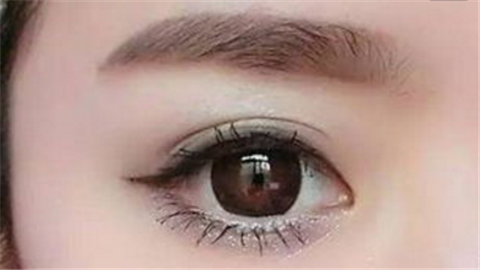 韓式開內眼角多少錢？價錢貴不貴？