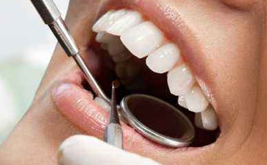 超聲波洗牙一次多少錢？價錢怎么樣？