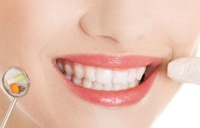 合金烤瓷牙多少錢一個？價錢貴不貴？