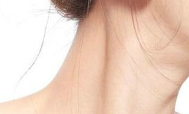 嗨體去頸紋能維持多久？一般打嗨體多少錢？