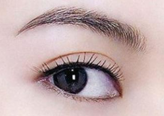 開眼角手術(shù)腫嗎？