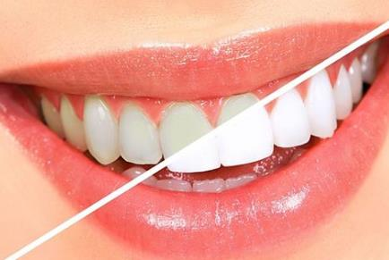 杭州牙齒種植整形醫(yī)院哪家好？2022排行榜前六實力強大！