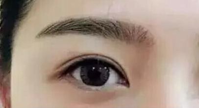 西安割雙眼皮效果好的醫(yī)院有哪幾家？人氣前六盤點！