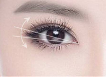 桂林開眼角整形醫(yī)院哪幾家好？10家正規(guī)機構(gòu)供你挑選！