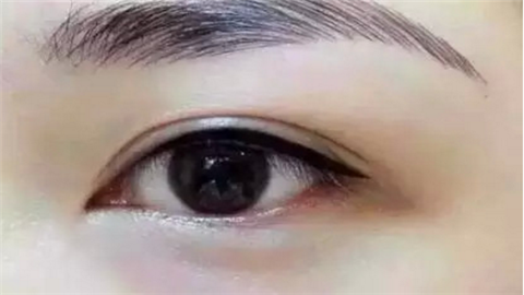 貴陽眼部整形醫(yī)院排名一覽！這10家醫(yī)院實力人氣口碑具在！