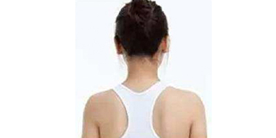 熱立塑術(shù)后