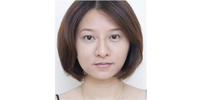 玻尿酸去法令紋術(shù)后