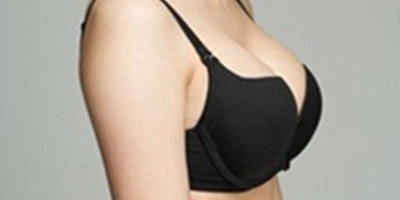 假體隆胸術(shù)后