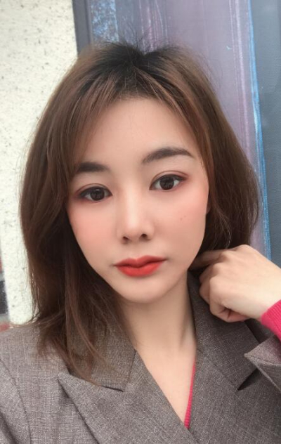  廈門華美名媛整形美容醫(yī)院俞積貴雙眼皮案例效果分享