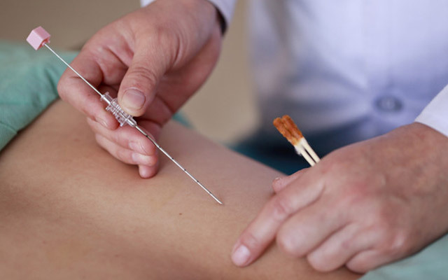 埋線減肥多少錢一次？埋線減肥多久才能有效果？