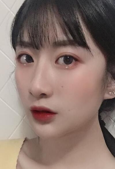 珠海陸達美容外科醫(yī)院做下頜角術(shù)后效果恢復(fù)的很好