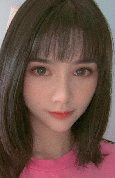 長(zhǎng)春亞韓醫(yī)學(xué)美容醫(yī)院魏家賓面部吸脂案例效果分享