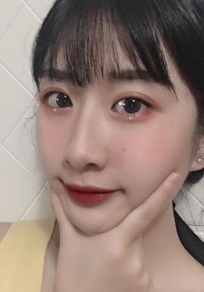 珠海陸達美容外科醫(yī)院做下頜角后完成小臉的蛻變