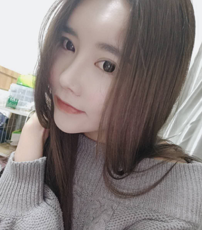 上海藝星醫(yī)療美容醫(yī)院崔海天顴骨降低案例效果分享