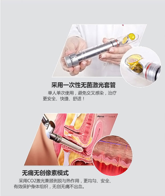成都愛爾麗整形激光緊縮陰道怎么樣？激光緊縮陰道注意什么？