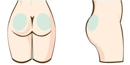 成都大華韓藝做臀部吸脂減肥安全性如何有什么特點(diǎn)？