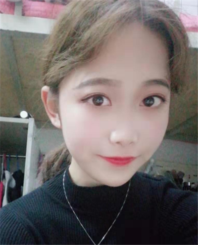 蘇州美貝爾美容醫(yī)院龔斌面部吸脂案例效果分享