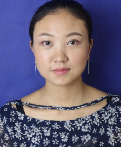 蘇州同濟醫(yī)院整形美容中心胡慧敏去眼袋案例效果分享