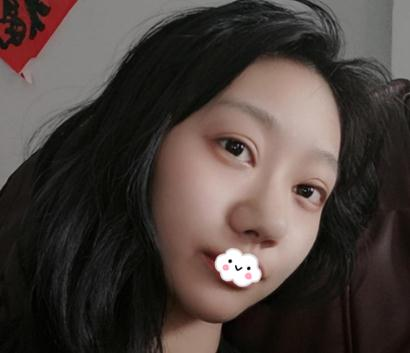 上海伊美爾港華做的3w的鼻子，你們說值不值