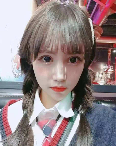 成都美立方（原華博）醫(yī)療美容醫(yī)院張娟眼部修復(fù)案例效果分享