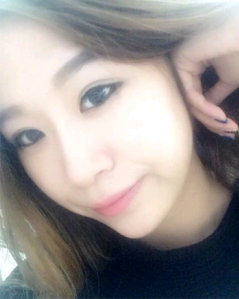 上海時(shí)光整形外科醫(yī)院趙克昶做耳軟骨隆鼻案例效果分享